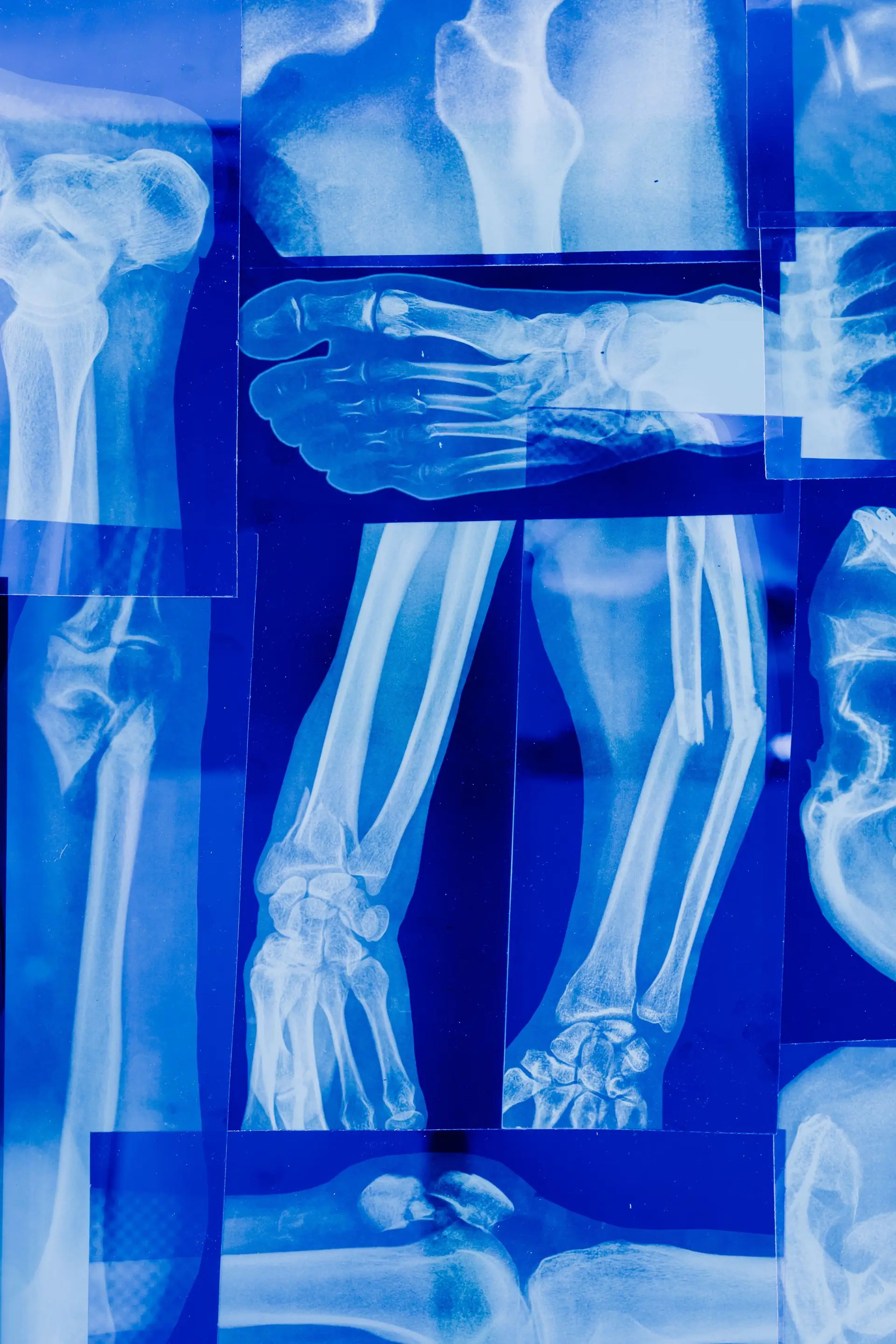 X-ray imaging of human bones in an orthopedic department